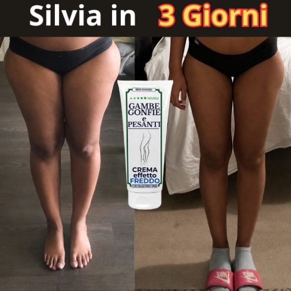 testim gambe gonfie (2) (1)