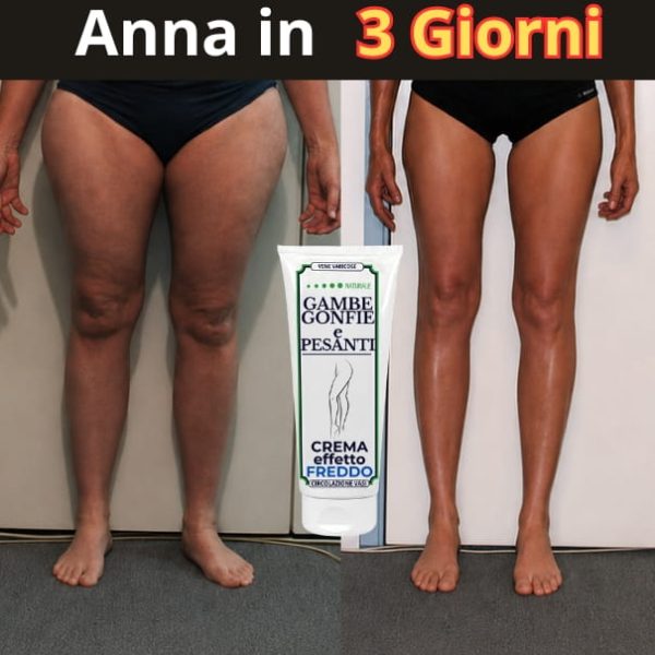 testim gambe gonfie (4) (1)