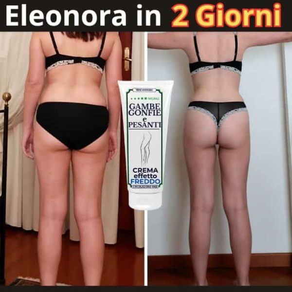 testim gambe gonfie (5) (1)